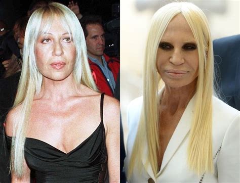 donatella versace face daily mail|donatella versace before plastic surgery.